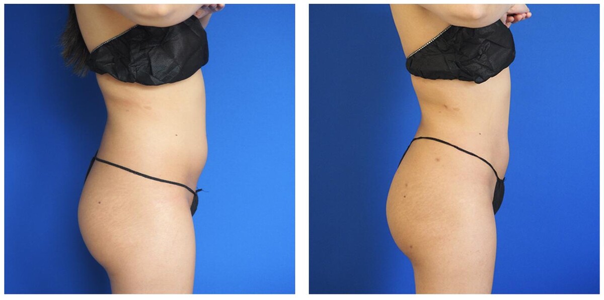 Images Ethos Plastic Surgery: Ginger Xu, M.D.