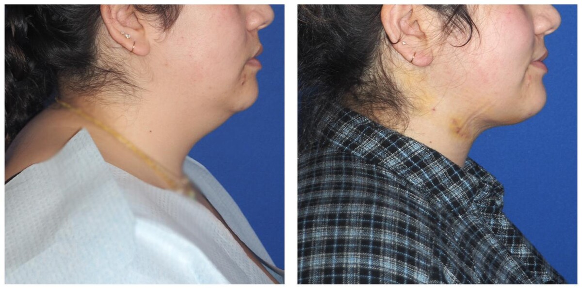 Images Ethos Plastic Surgery: Ginger Xu, M.D.