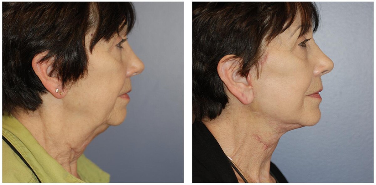 Images Ethos Plastic Surgery: Ginger Xu, M.D.