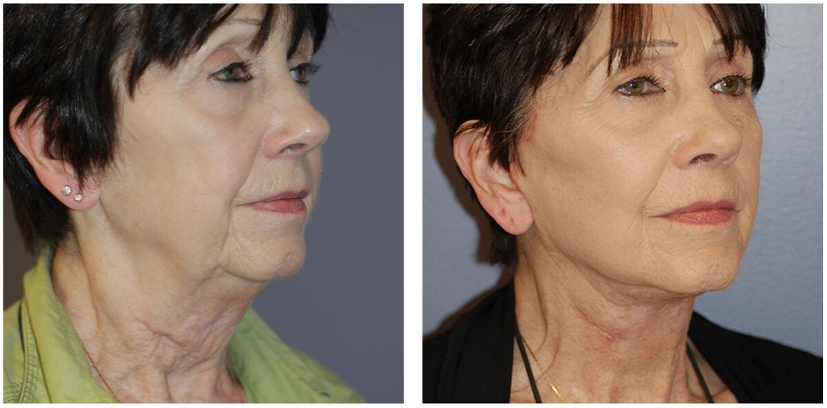 Images Ethos Plastic Surgery: Ginger Xu, M.D.