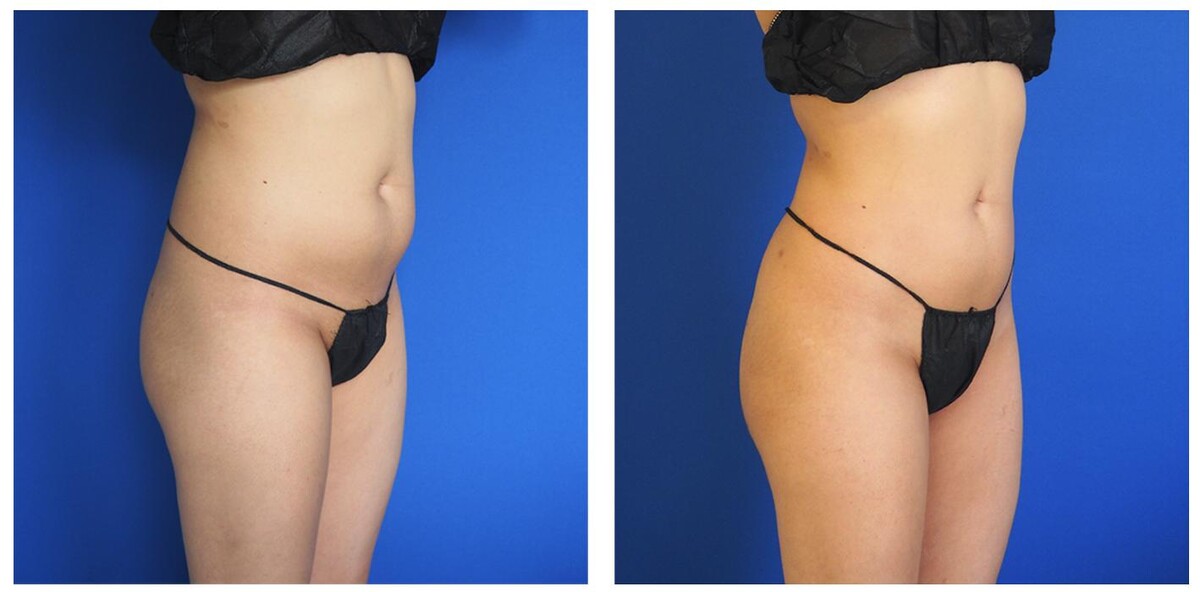 Images Ethos Plastic Surgery: Ginger Xu, M.D.