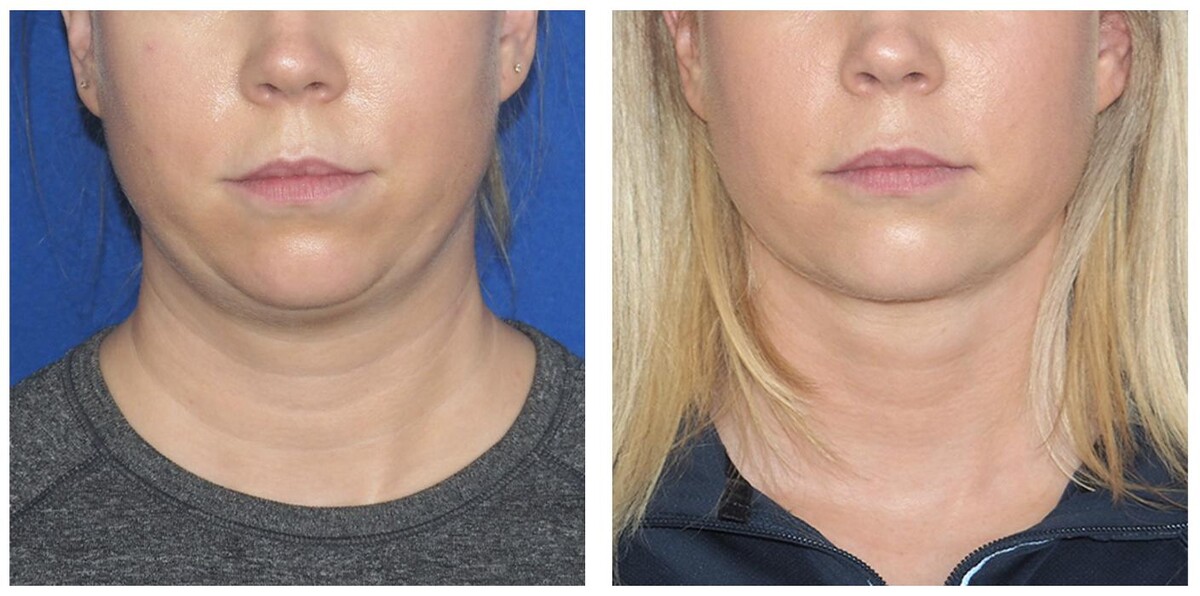 Images Ethos Plastic Surgery: Ginger Xu, M.D.