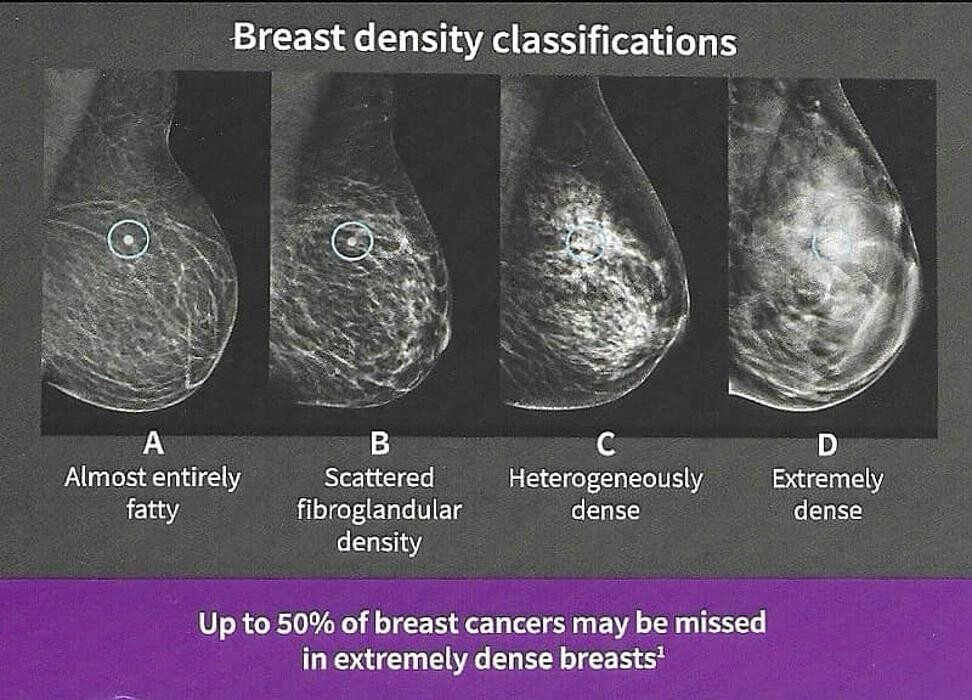 Images Gulf Islands Medical Imaging