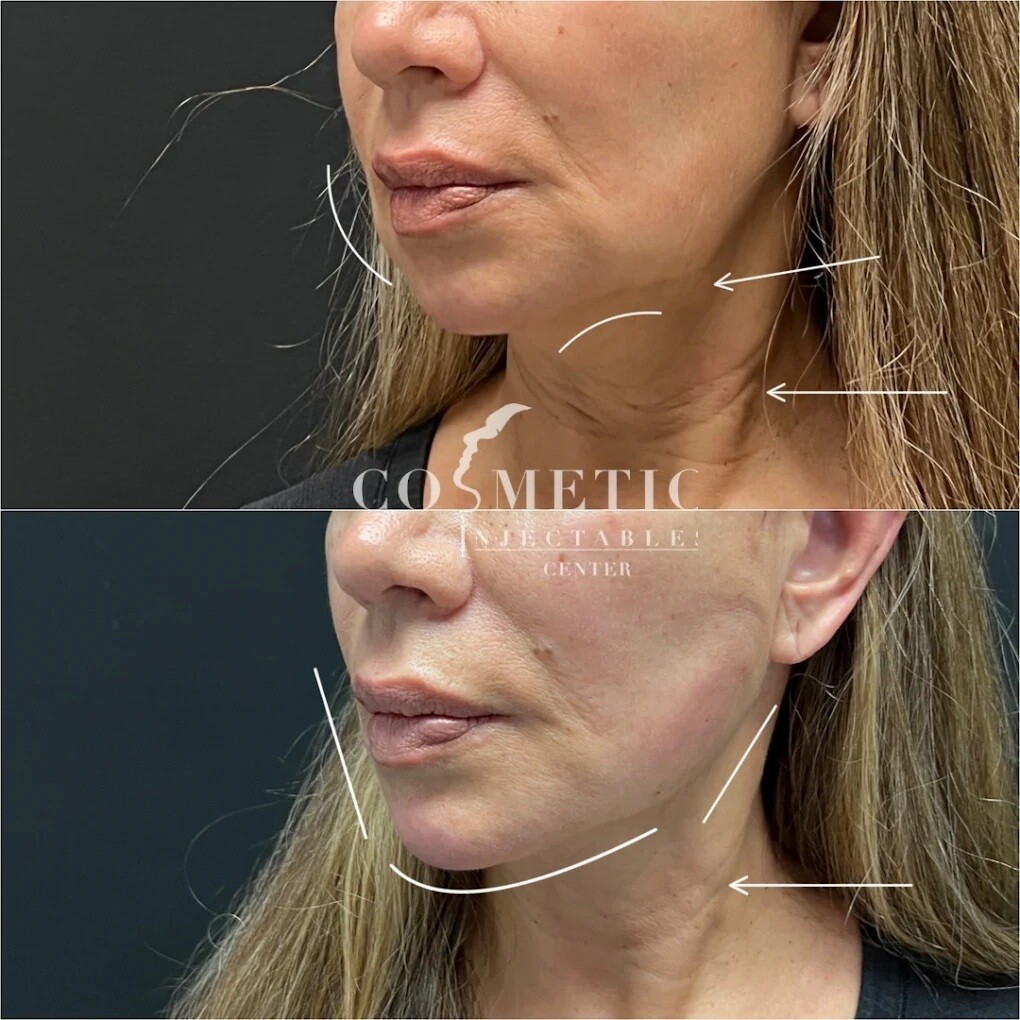 Images Cosmetic Injectables Center Medspa
