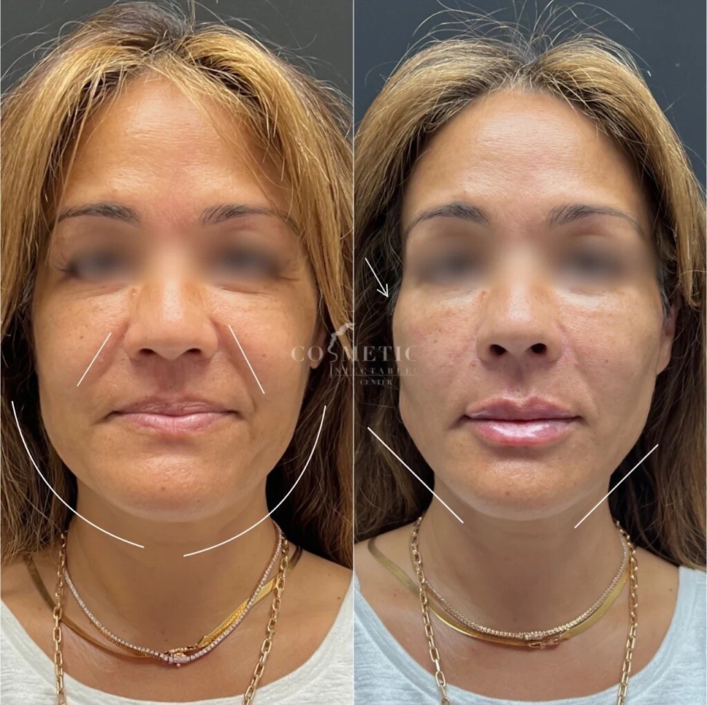 Images Cosmetic Injectables Center Medspa