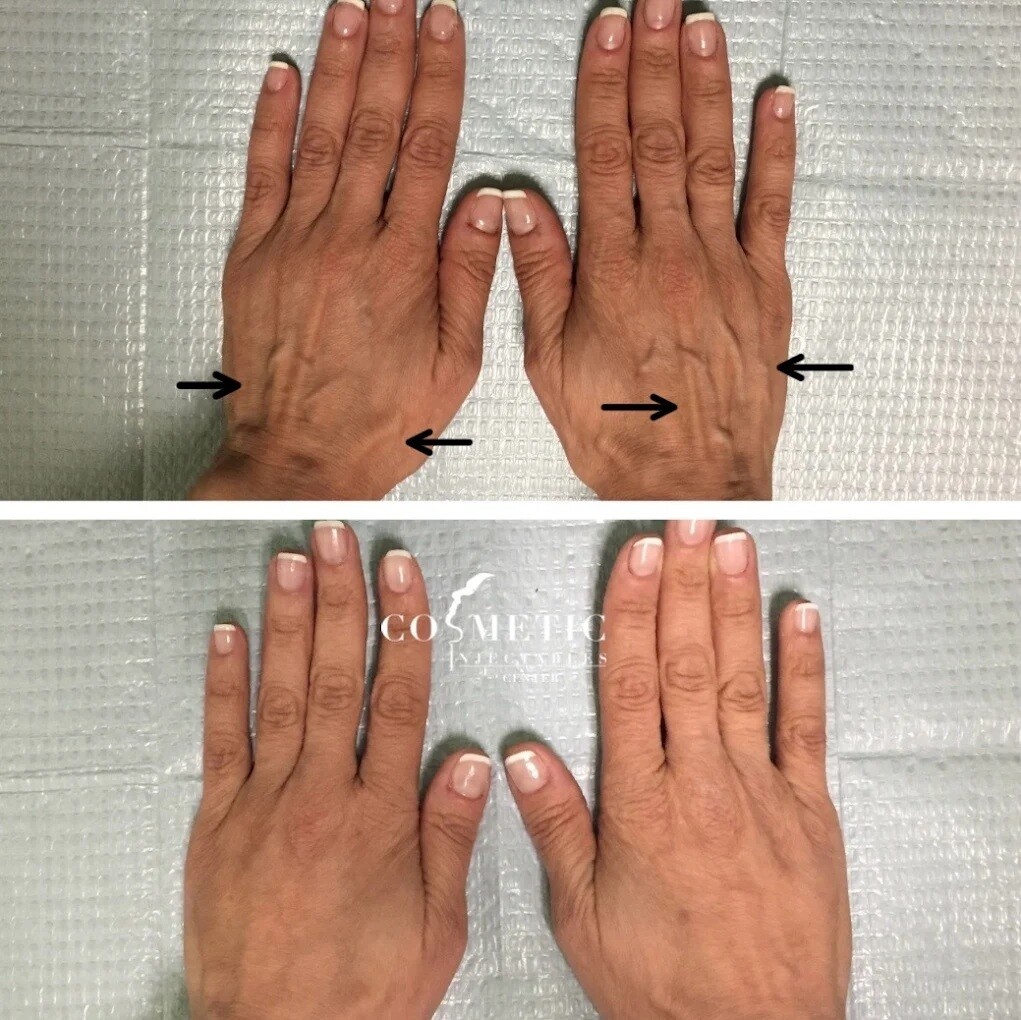 Images Cosmetic Injectables Center Medspa