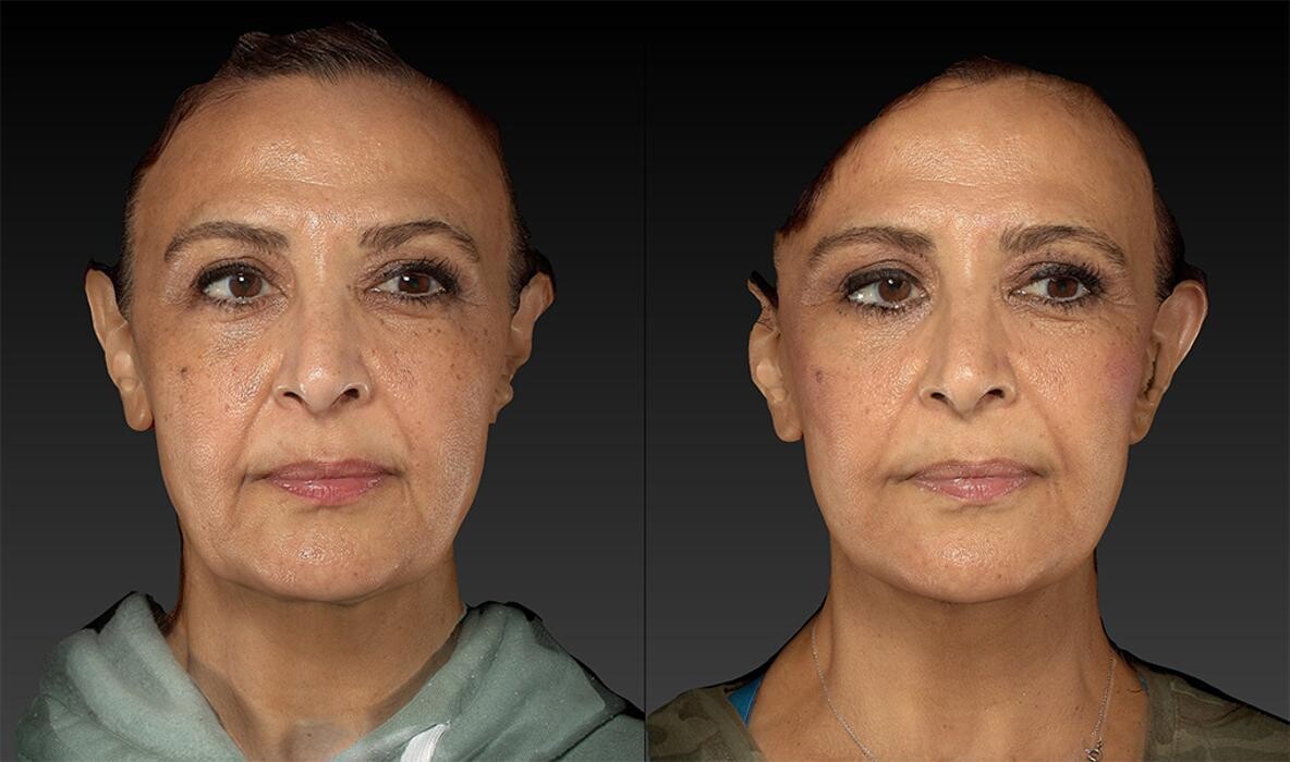 Images Stepanyan Surgical Arts Center: Dr. Martin Stepanyan