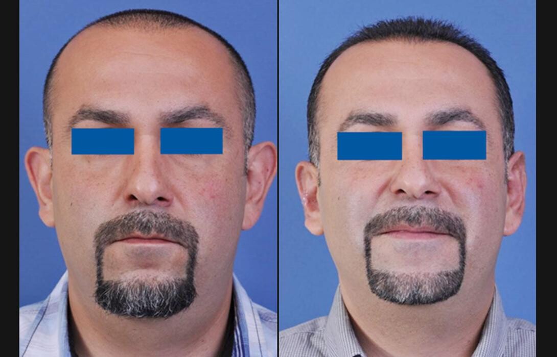 Images Stepanyan Surgical Arts Center: Dr. Martin Stepanyan