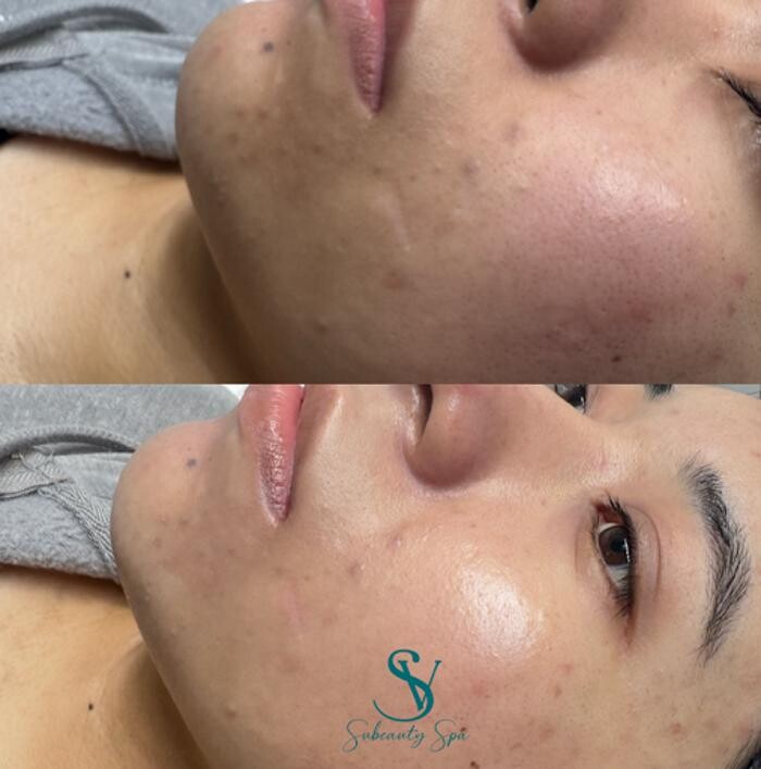 Images Subeautyspa