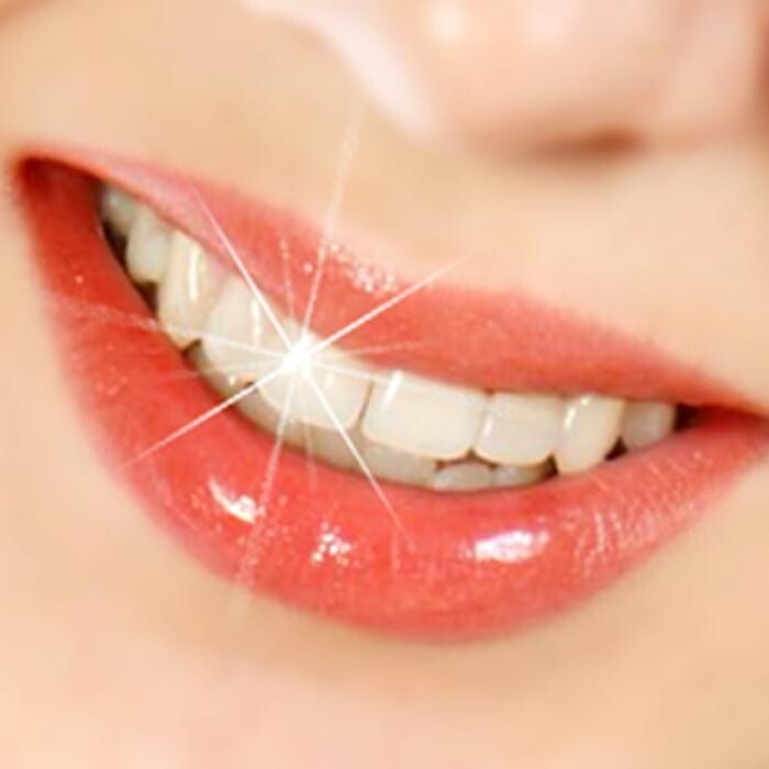 Images Smile Select Dental Alta Loma