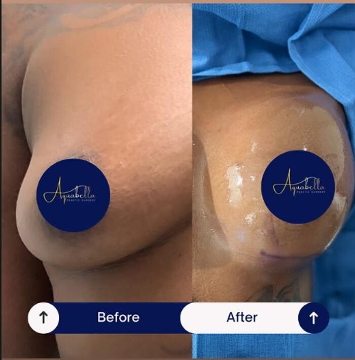 Images Aquabella Plastic Surgery