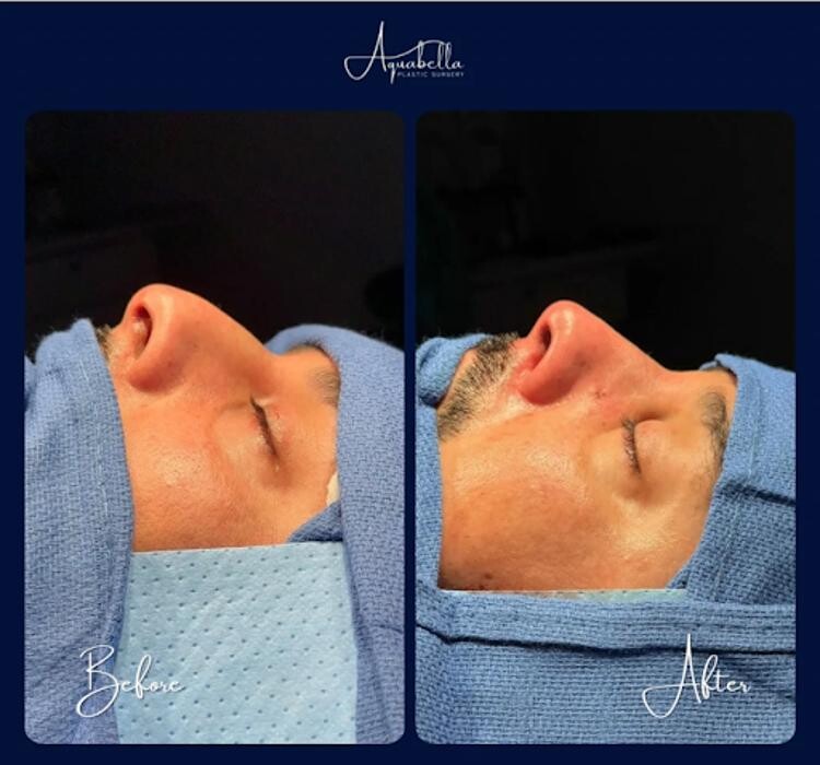 Images Aquabella Plastic Surgery