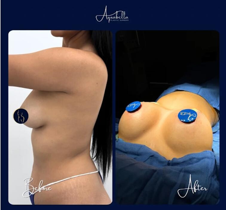 Images Aquabella Plastic Surgery