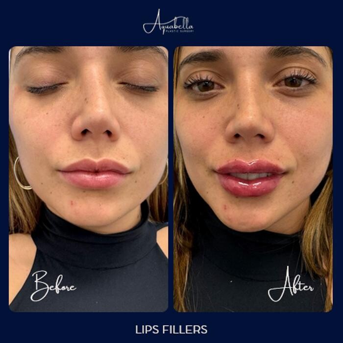 Images Aquabella Plastic Surgery