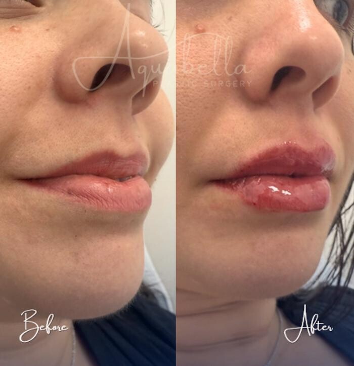 Images Aquabella Plastic Surgery