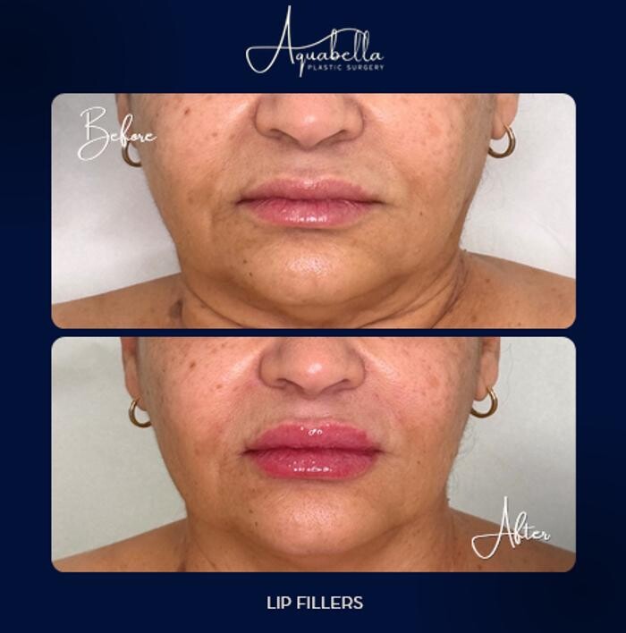Images Aquabella Plastic Surgery
