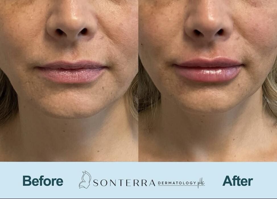 Images Sonterra Dermatology