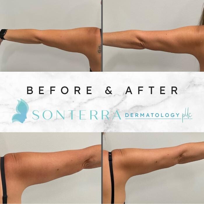 Images Sonterra Dermatology