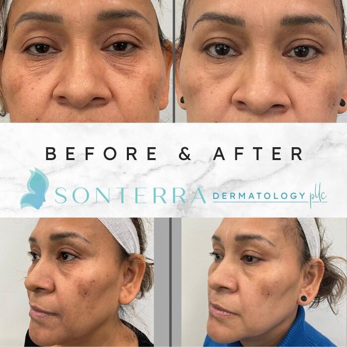 Images Sonterra Dermatology