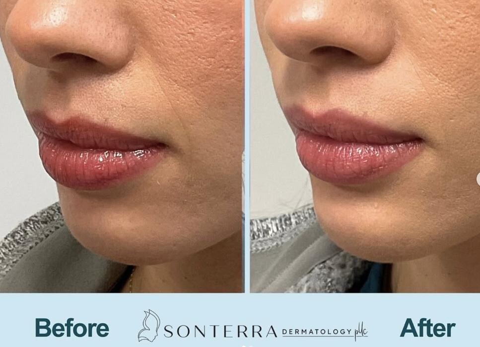 Images Sonterra Dermatology