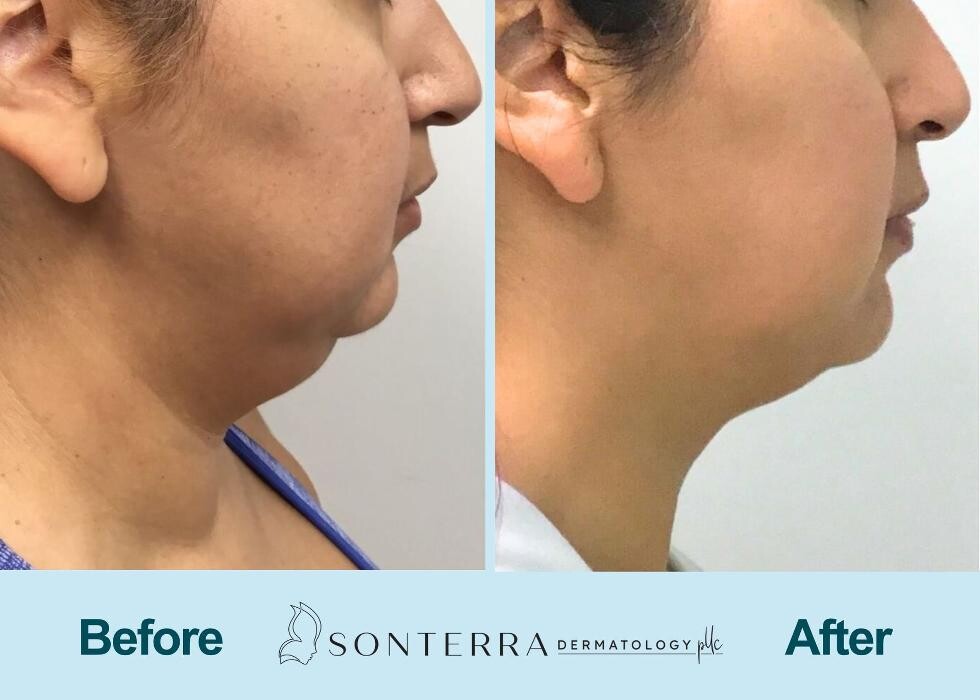 Images Sonterra Dermatology