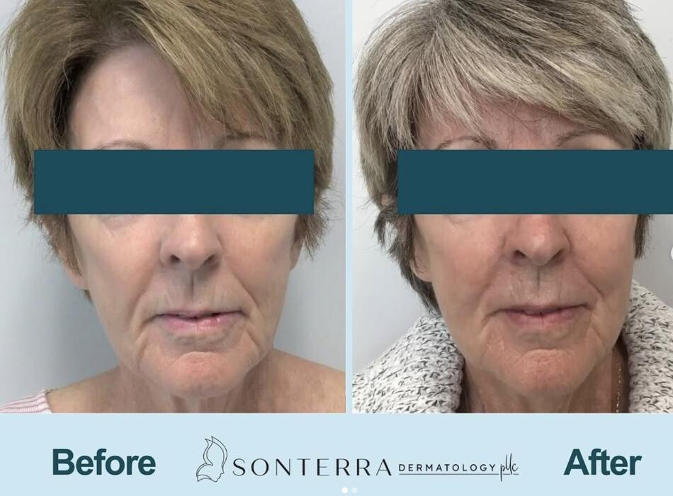 Images Sonterra Dermatology