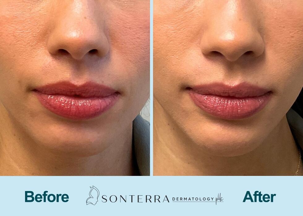 Images Sonterra Dermatology