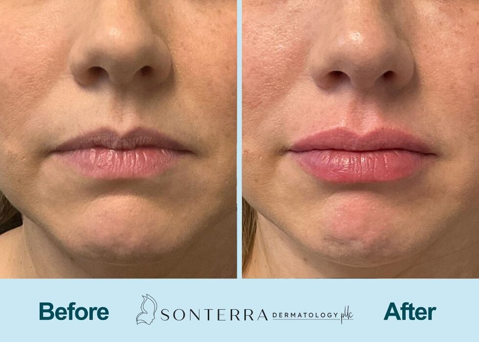 Images Sonterra Dermatology
