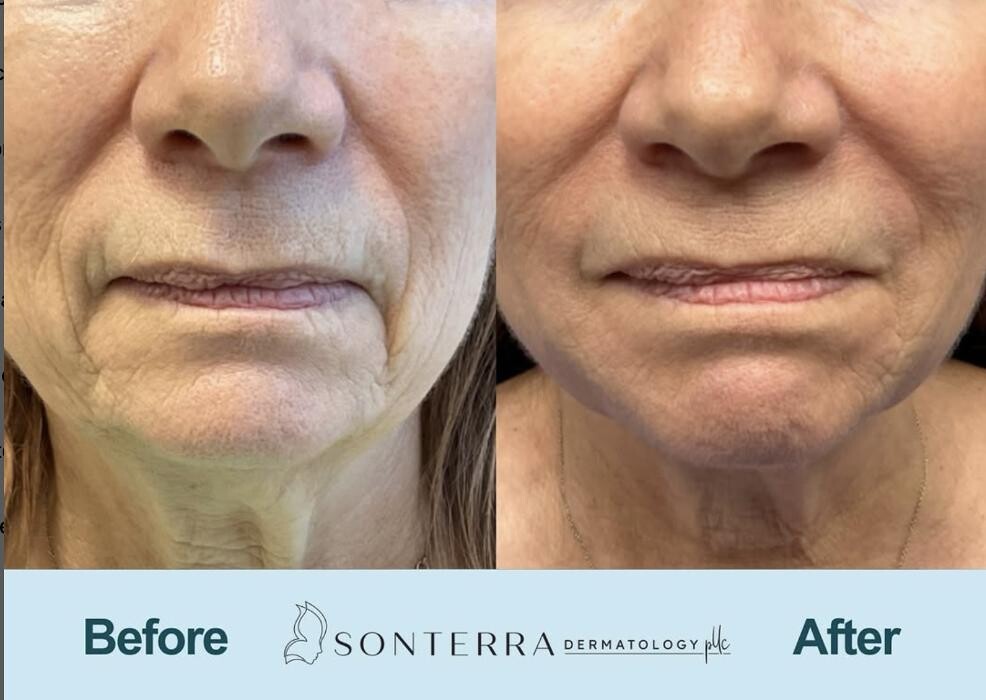Images Sonterra Dermatology