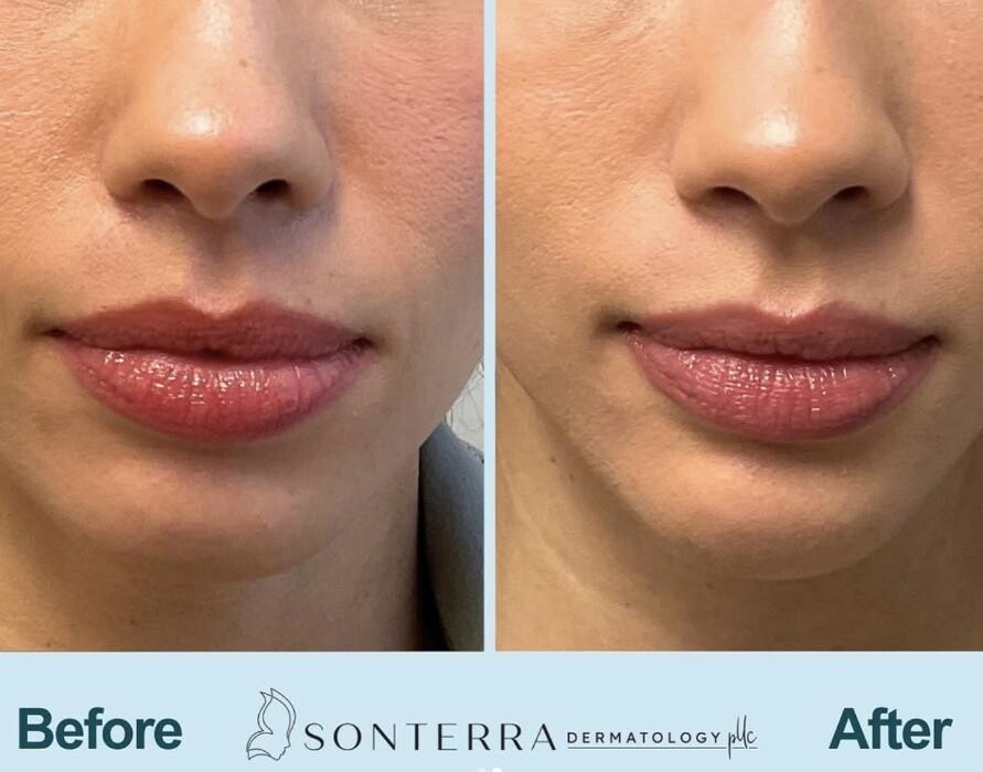 Images Sonterra Dermatology