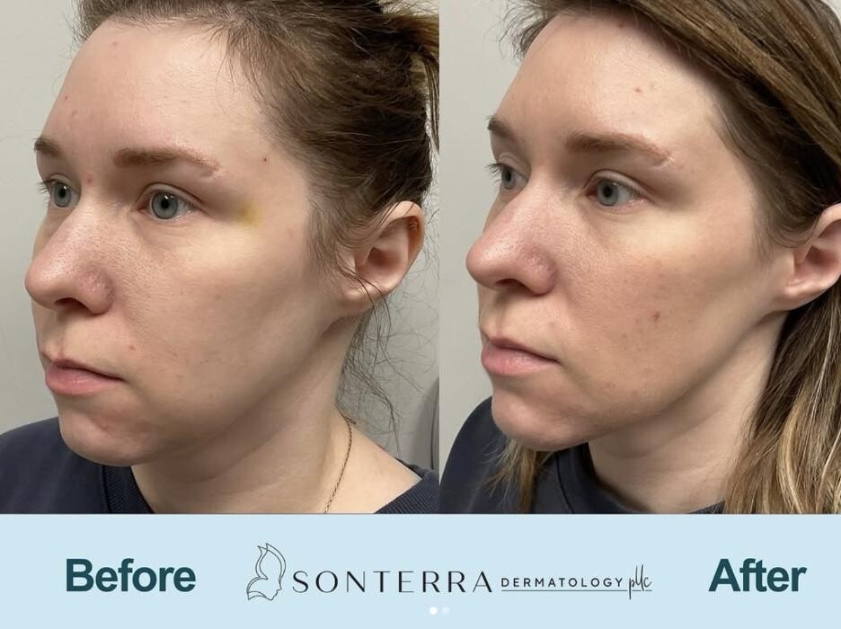Images Sonterra Dermatology