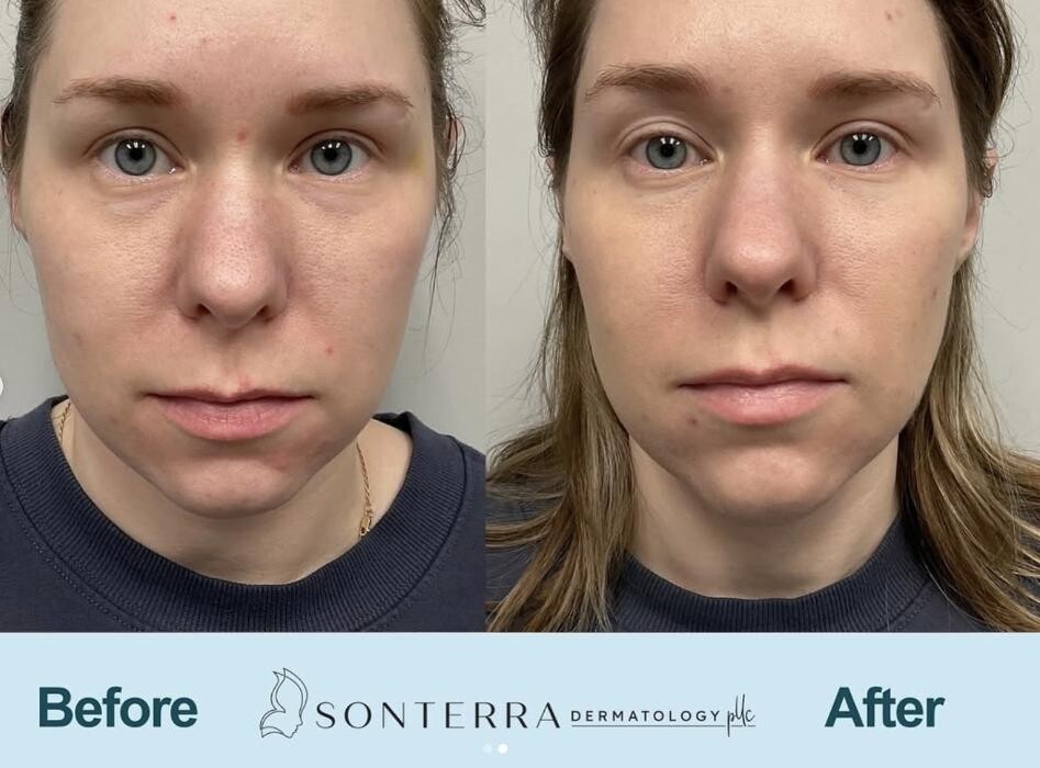 Images Sonterra Dermatology