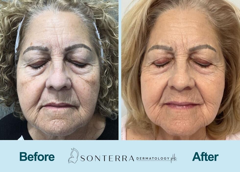 Images Sonterra Dermatology