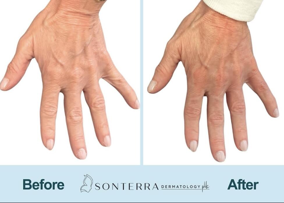 Images Sonterra Dermatology