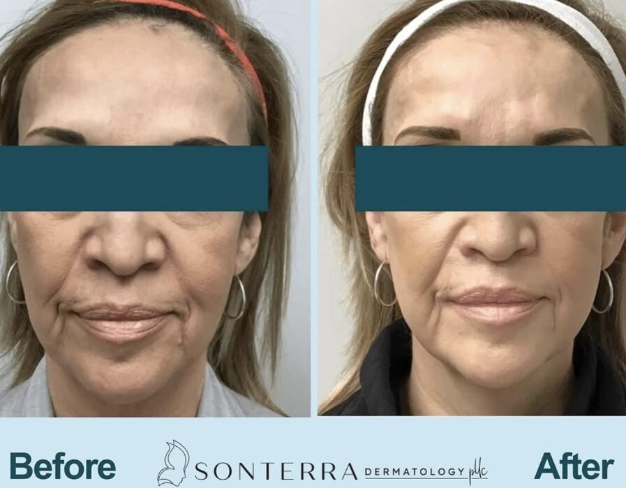 Images Sonterra Dermatology