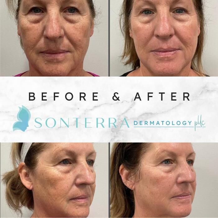 Images Sonterra Dermatology