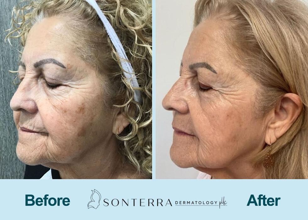 Images Sonterra Dermatology