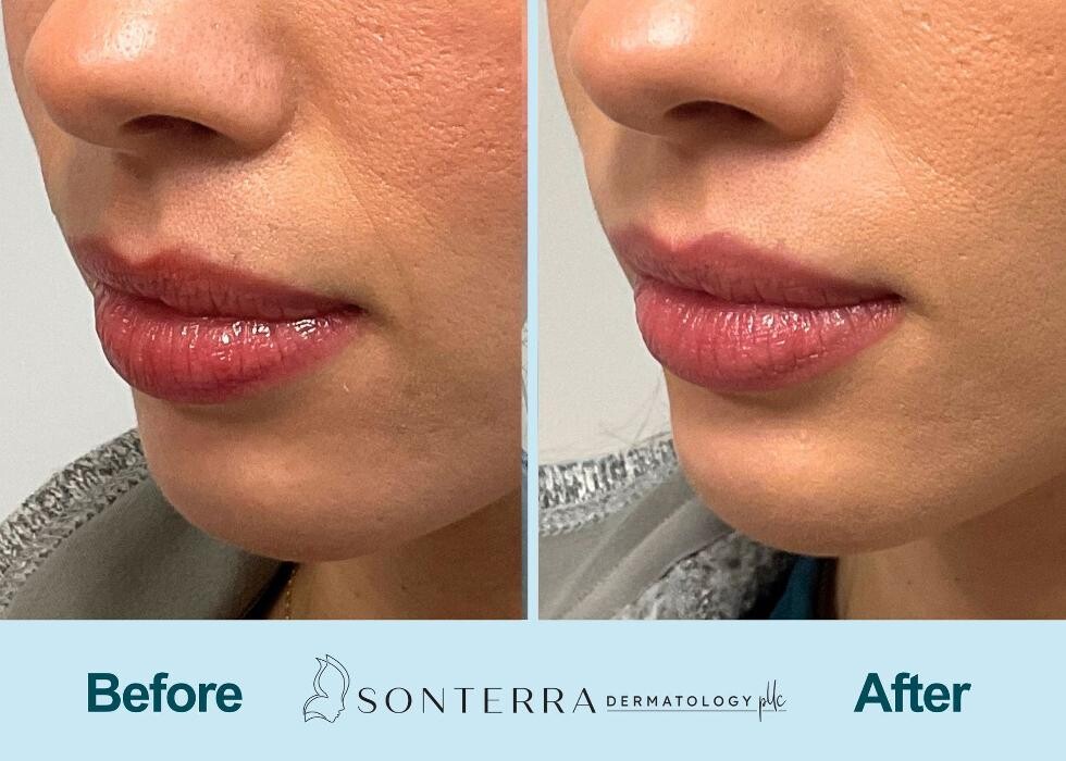 Images Sonterra Dermatology