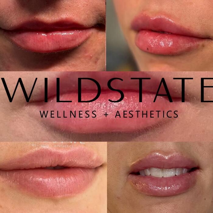 Images WildState Lawton