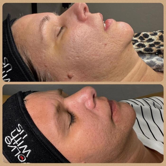 Images WildState Lawton