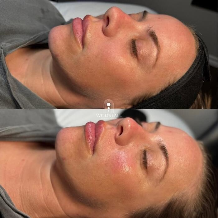 Images WildState Lawton