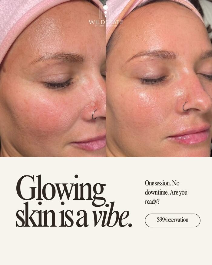 Images WildState Lawton