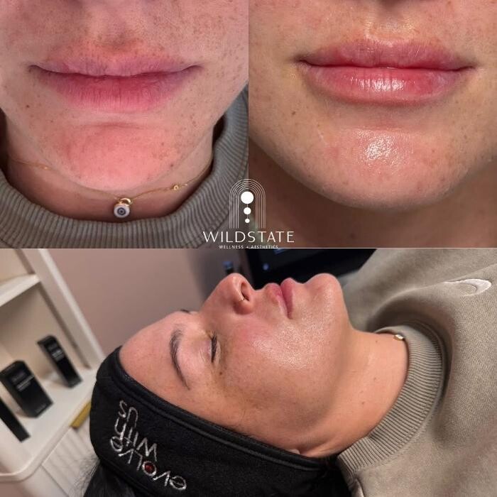 Images WildState Lawton