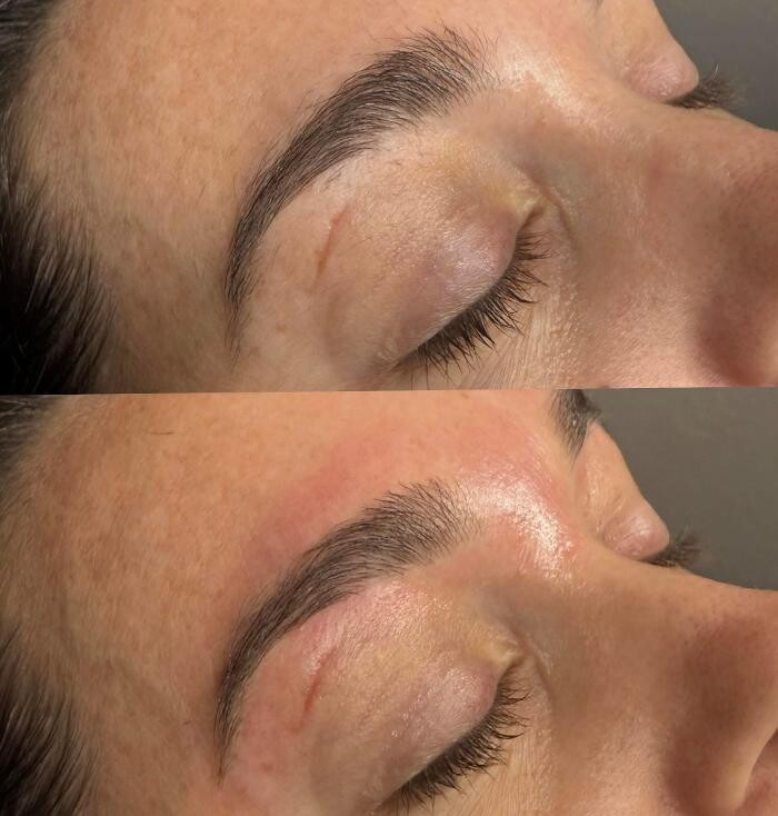 Images WildState Lawton