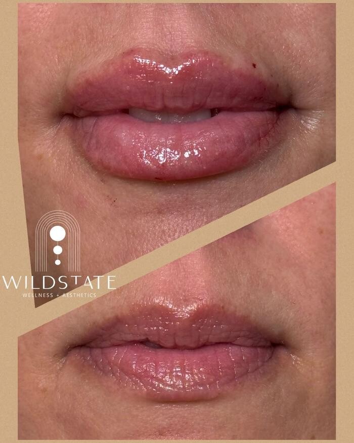 Images WildState Lawton