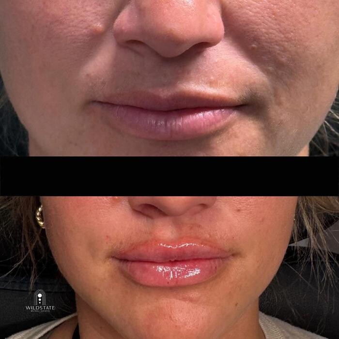 Images WildState Lawton