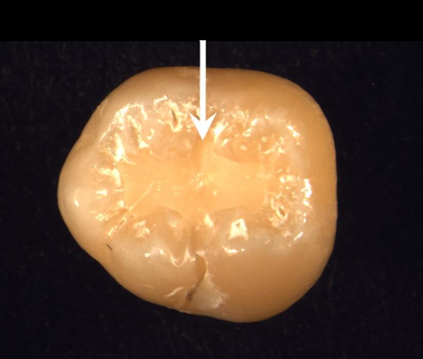 Images Portal Ridge Dental