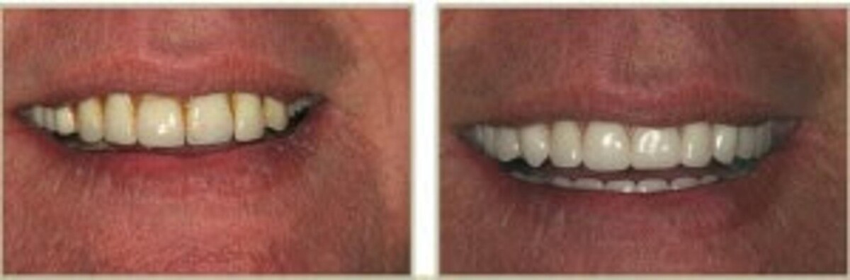 Images Brit Phillips, DDS