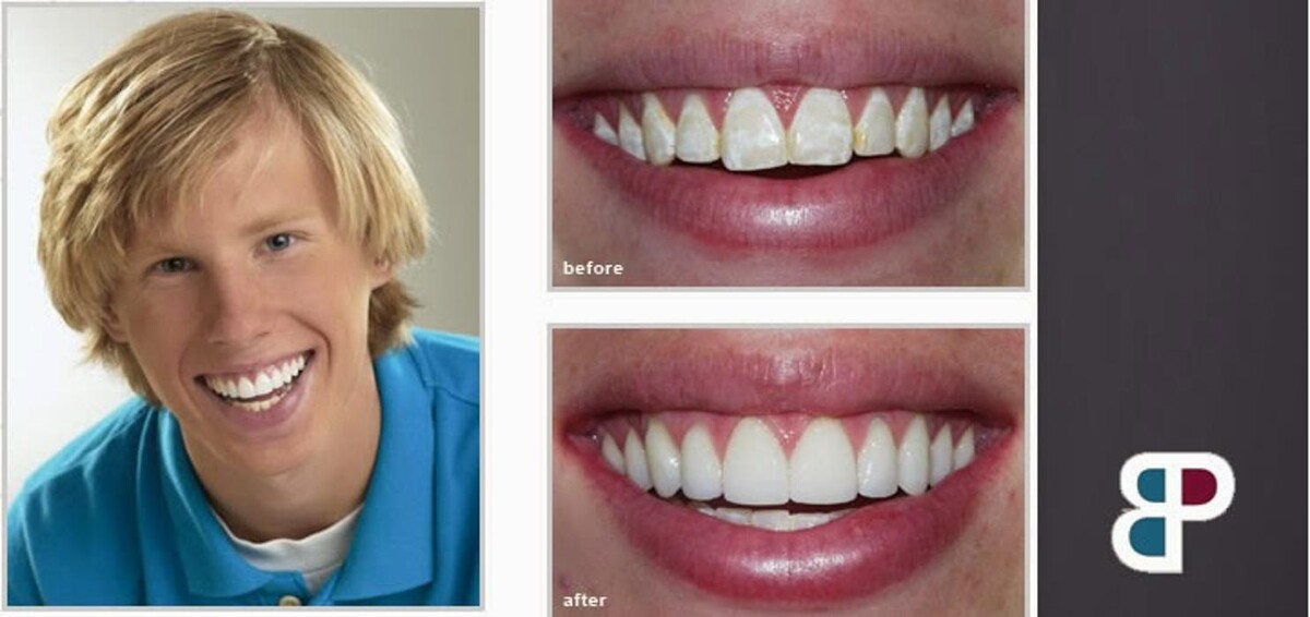 Images Brit Phillips, DDS