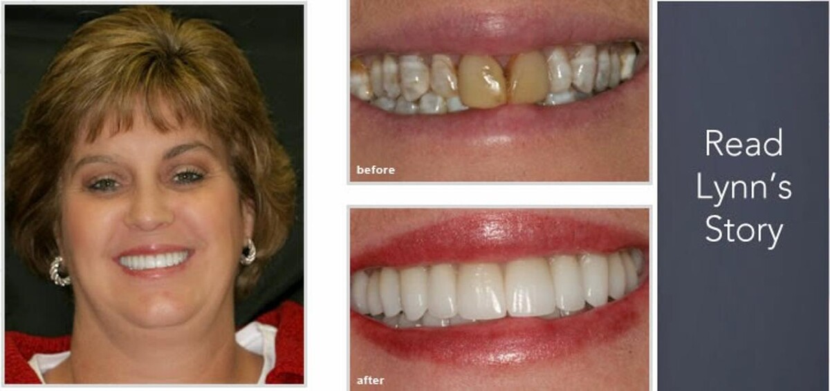Images Brit Phillips, DDS